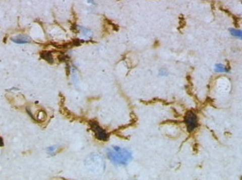 小胶质细胞【Microglia】 2026 06 20 5928f395 8037 4a42 b757 f7514b36a30e