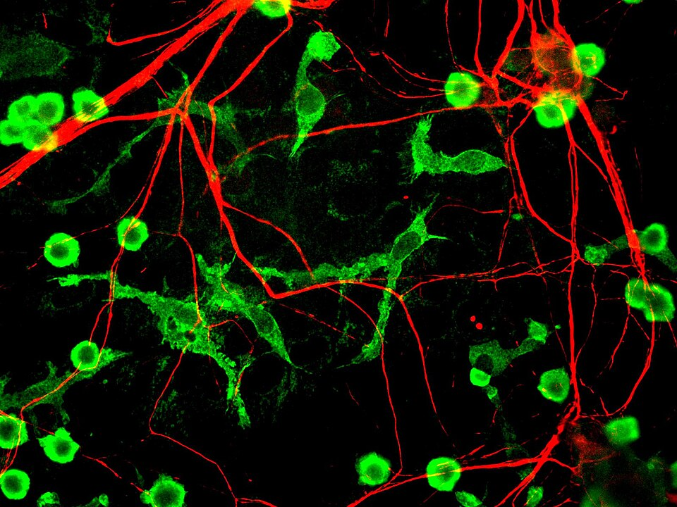 小胶质细胞（Microglia） 2026 06 18 823831e7 6f48 4a8c 8f08 2e1b36518e18